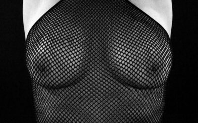 Condición fibroquística de la mama