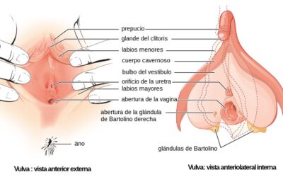 ¿Qué es la bartolinitis?